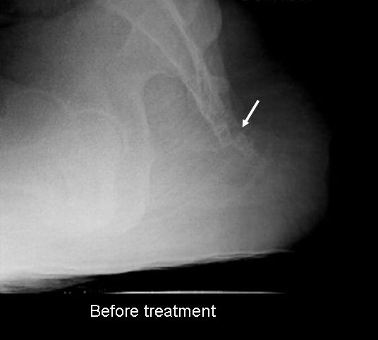 dislocation before treatment